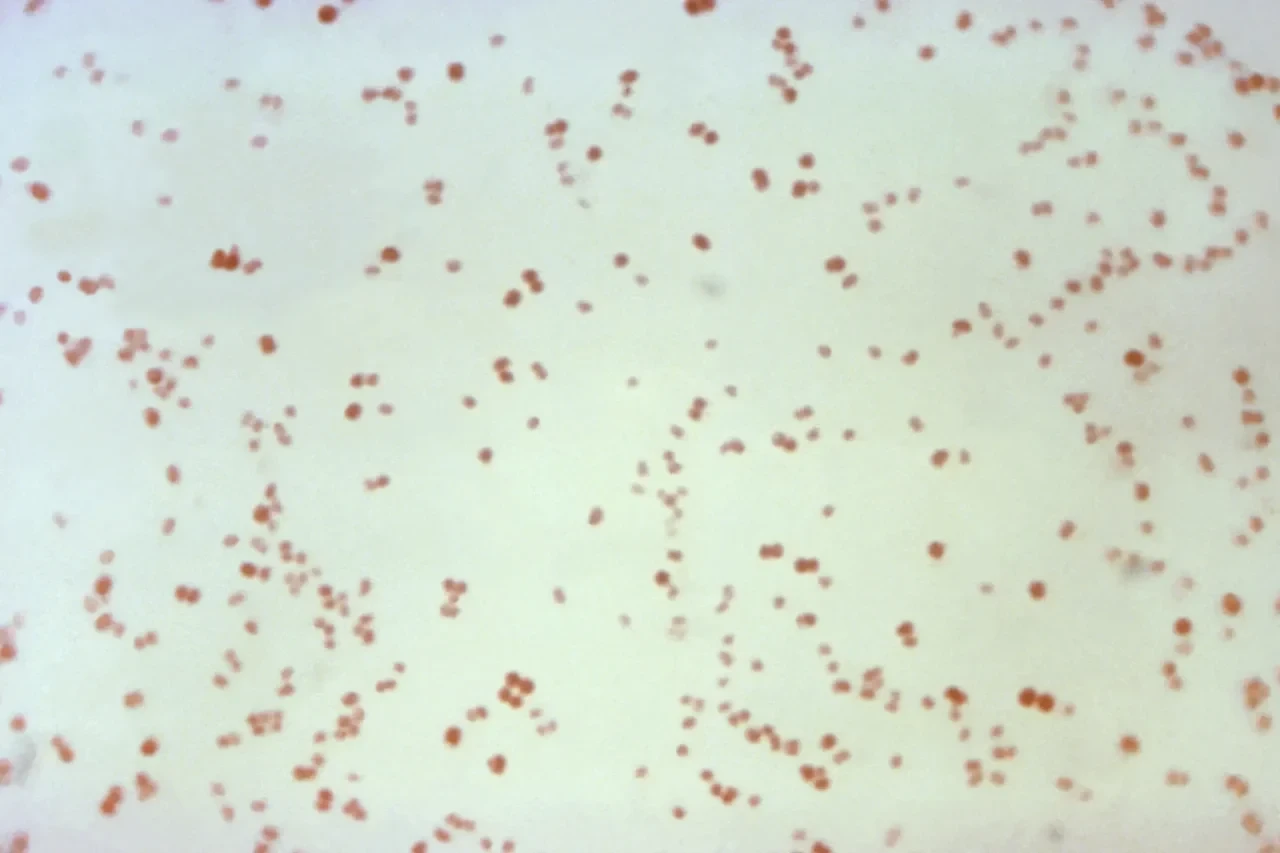 Mikroskopbild von 1971 zeigt Neisseria gonorrhoeae Bakterien, die die Geschlechtskrankheit Gonorrhö verursachen.