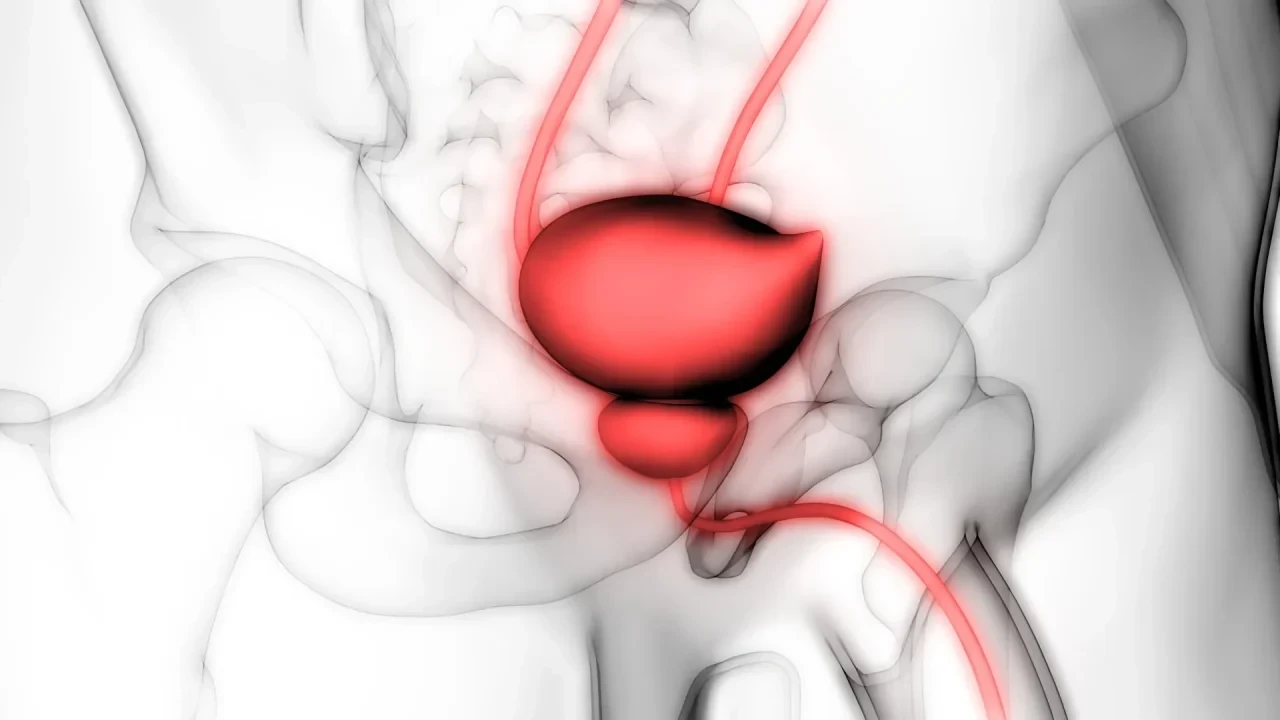 Schematische Darstellung der Prostata