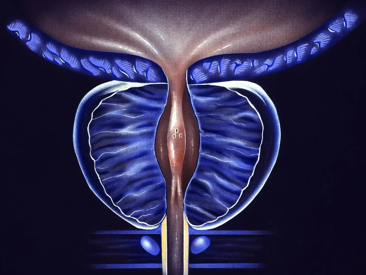 Schematische medizinische Illustration der Prostata, umgeben von Harnblase und Harnröhre