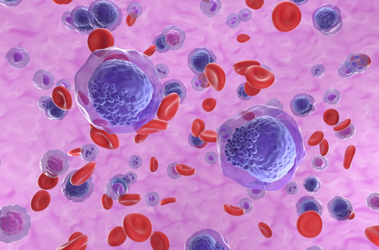 Akute myeloische Leukämie (AML)-Zellen im Blutkreislauf – isometrische Ansicht