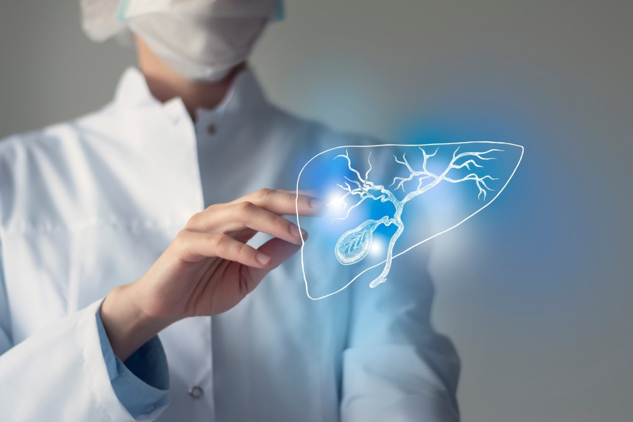 Ärztin zeigt auf Tumor Gallenblase in einer Projektion