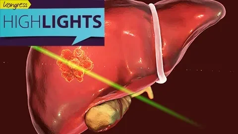 3D-Illustration einer menschlichen Leber; auf der Oberfläche ist ein leuchtend markierter Tumorherd sichtbar, der von einem grünen Laserstrahl gezielt getroffen wird