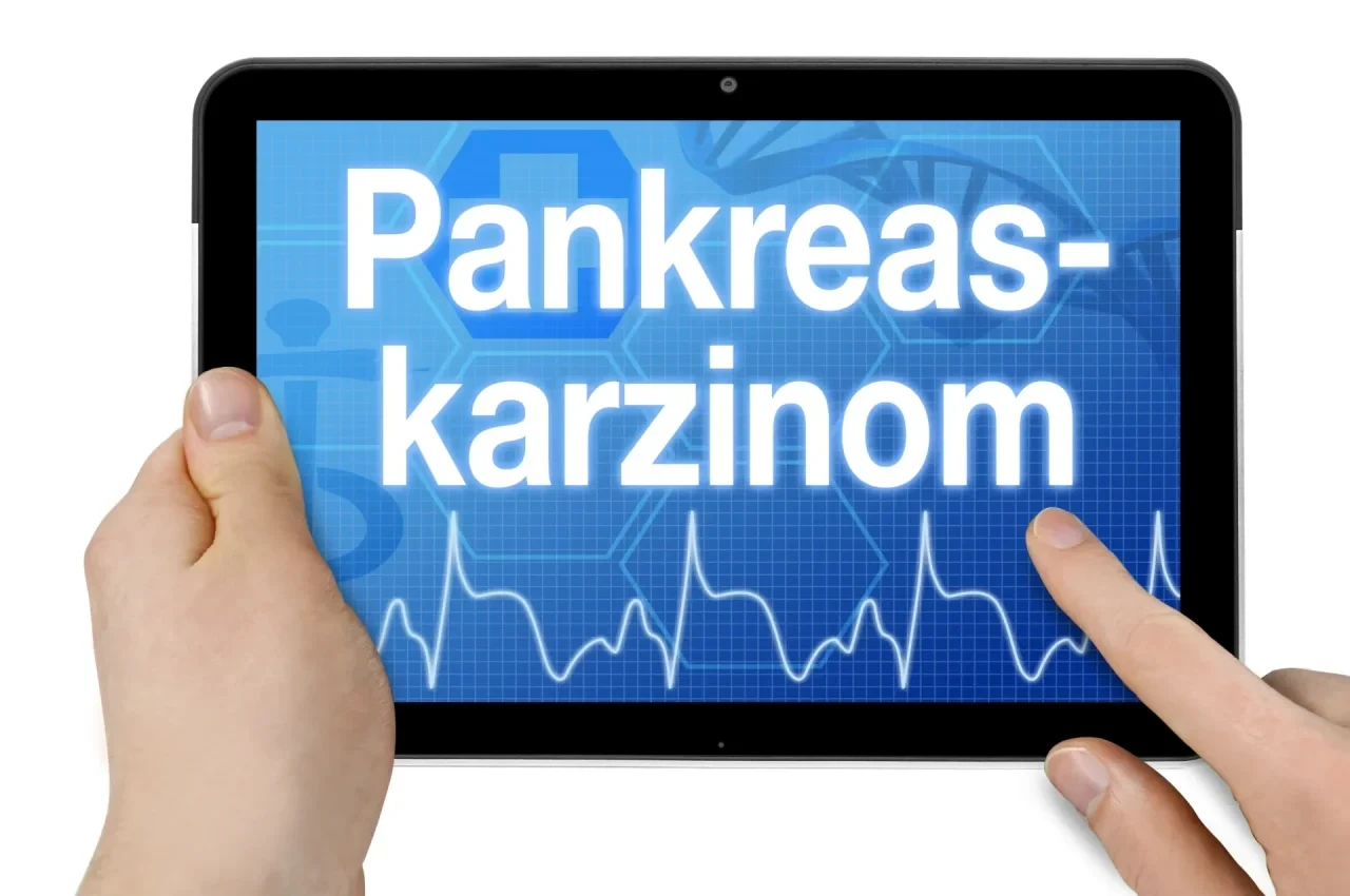 Zwei Hände bedienen ein Tablet, auf dessen Bildschirm das Wort „Pankreaskarzinom“ groß dargestellt ist.