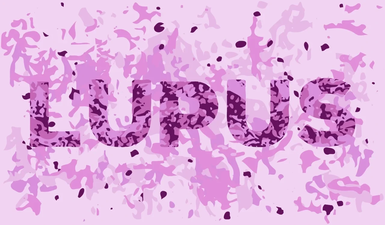 systemischer Lupus erythematodes