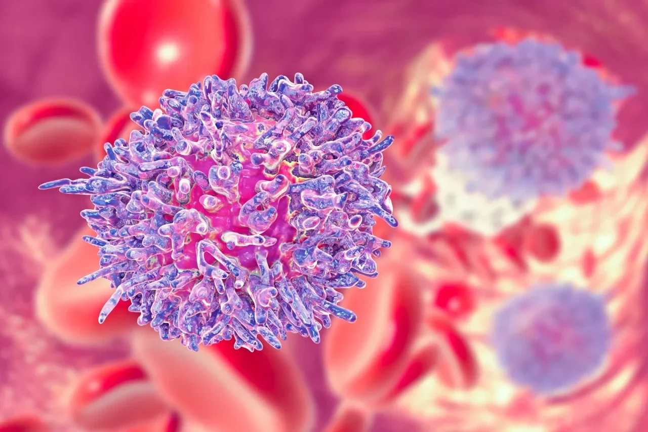 Mikroskopische Darstellung leukämischer Lymphozyten