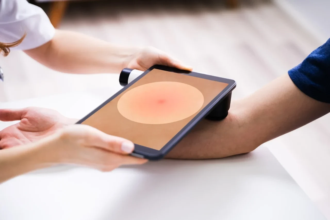 Dermatologische Untersuchung der Haut am Arm mit dem Tablet