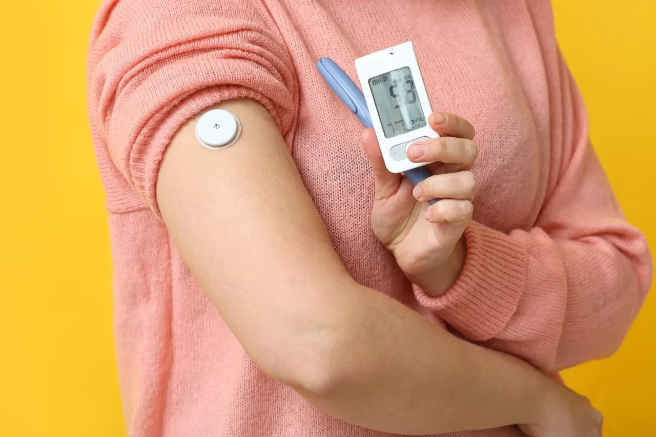 Frau mit CGM-Sensor am Oberarm liest Glukosewert am Smartphone ab. In der anderen Hand hält sie einen Insulin-Pen