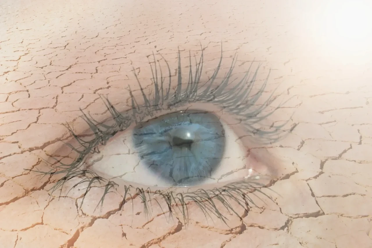 Nahaufnahme eines menschlichen Auges mit blauer Iris, umgeben von extrem trockener, rissiger Haut, die an eine ausgetrocknete Wüstenlandschaft erinnert.