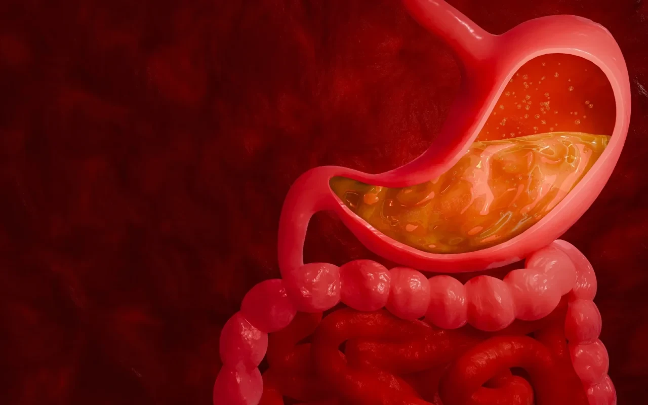 Reflux