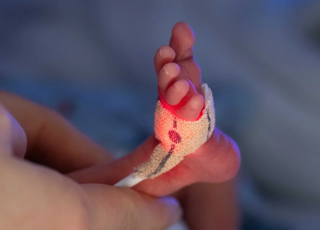 Vorsichtig überprüft eine Krankenschwester auf einer Frühchenstation den korrekten Sitz einer Sauerstoffsonde am winzigen Fuß eines erst wenige Tage alten Frühchens in einer Klinik