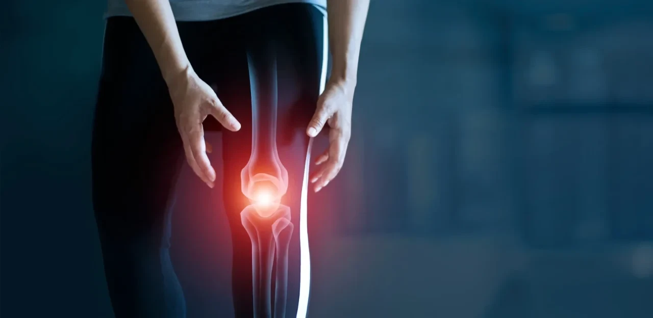 Person in dunkler Sportbekleidung mit schmerzhaft markiertem Kniegelenk; das Knie wird durch eine medizinische Grafik mit hervorgehobenen Knochenstrukturen und roter Leuchtmarkierung dargestellt.