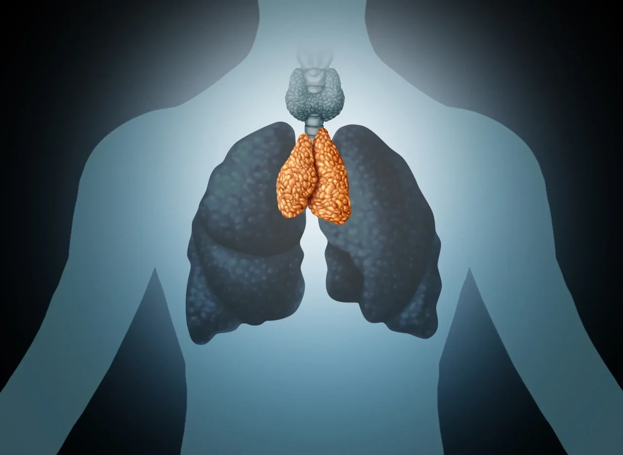 Anatomische Illustration eines menschlichen Oberkörpers mit dunkel dargestellten Lungen und orange hervorgehobenem Thymus zwischen den Lungenflügeln.