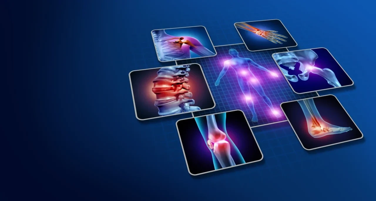 Typische Prädilektionsstellen der rheumatoiden Arthritis: Schulter, Hand, Halswirbelsäule, Hüfte, Knie und Sprunggelenk mit hervorgehobenen Schmerzpunkten