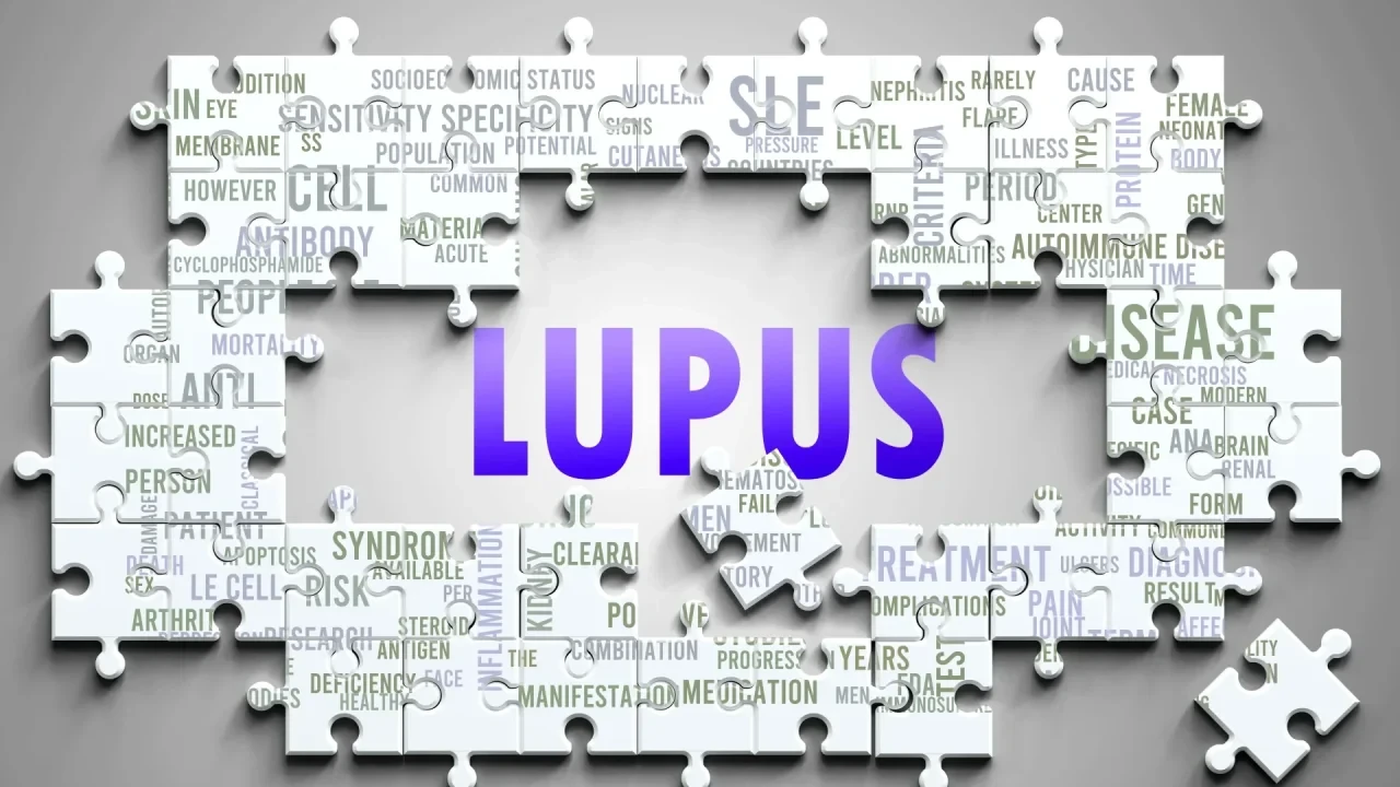 Systemischer Lupus erythematodes als Puzzle mit Begriffen zu Komorbiditäten, Krankheitsaktivität und Therapie