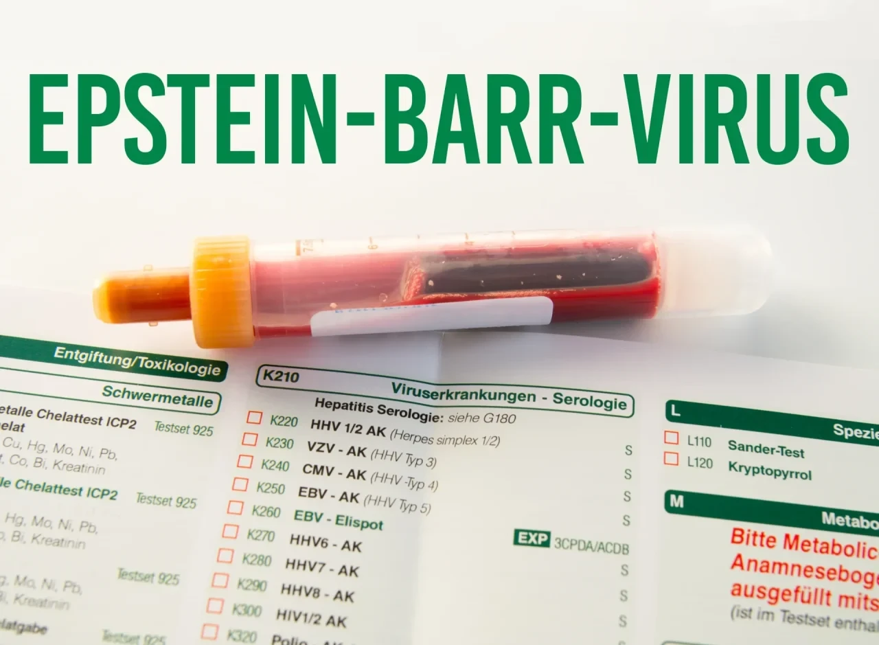 Epstein-Barr-Virus: Blutprobe auf Laborzettel