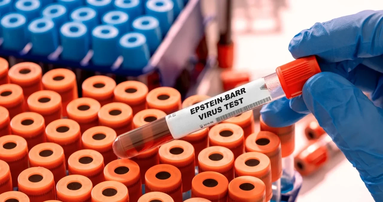Epstein-Barr-Virus Teströhrchen
