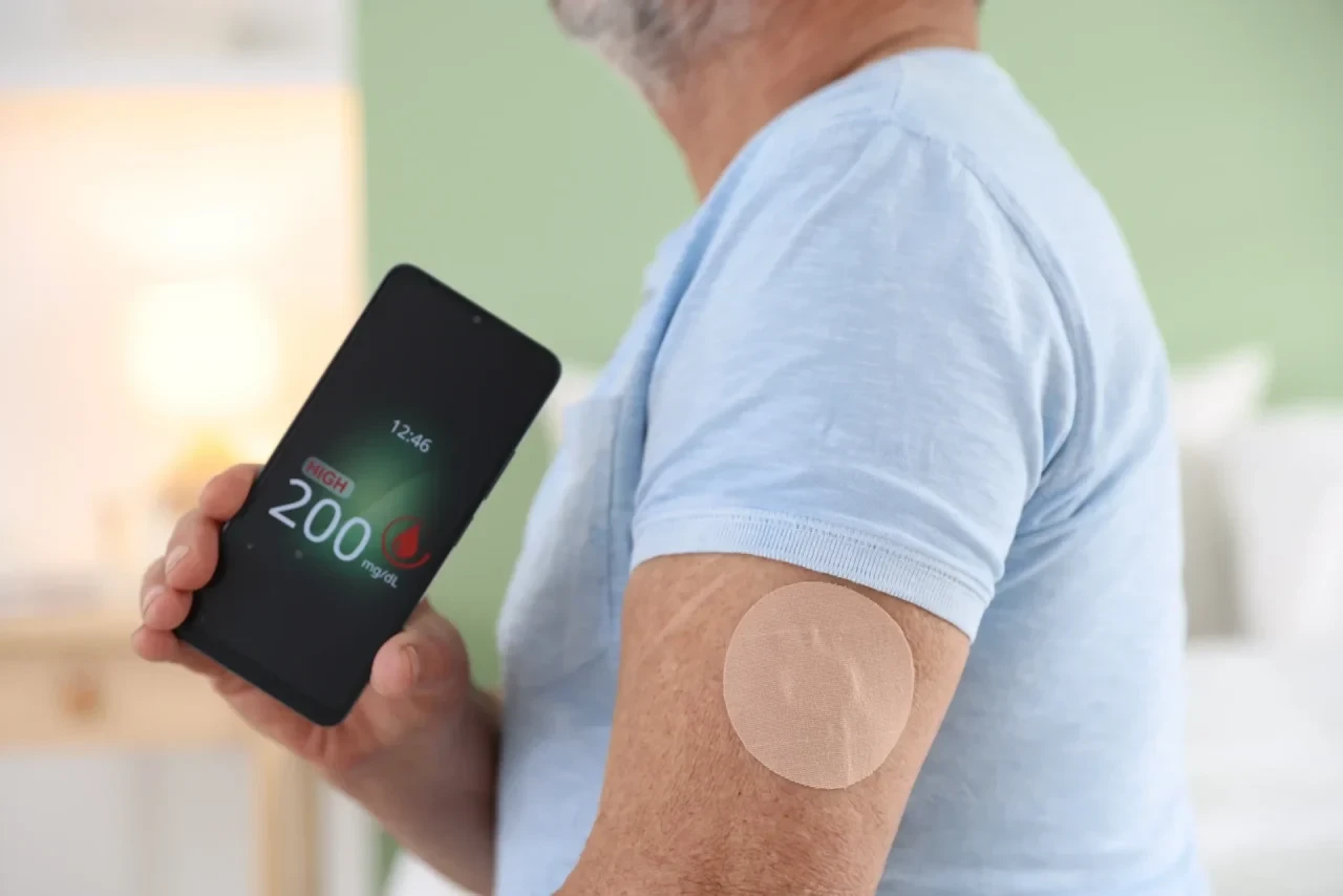 Person hält ein Smartphone mit angezeigtem Glukosewert in der Hand; am Oberarm ist ein Sensor für das kontinuierliche Glukosemonitoring (CGM) befestigt.