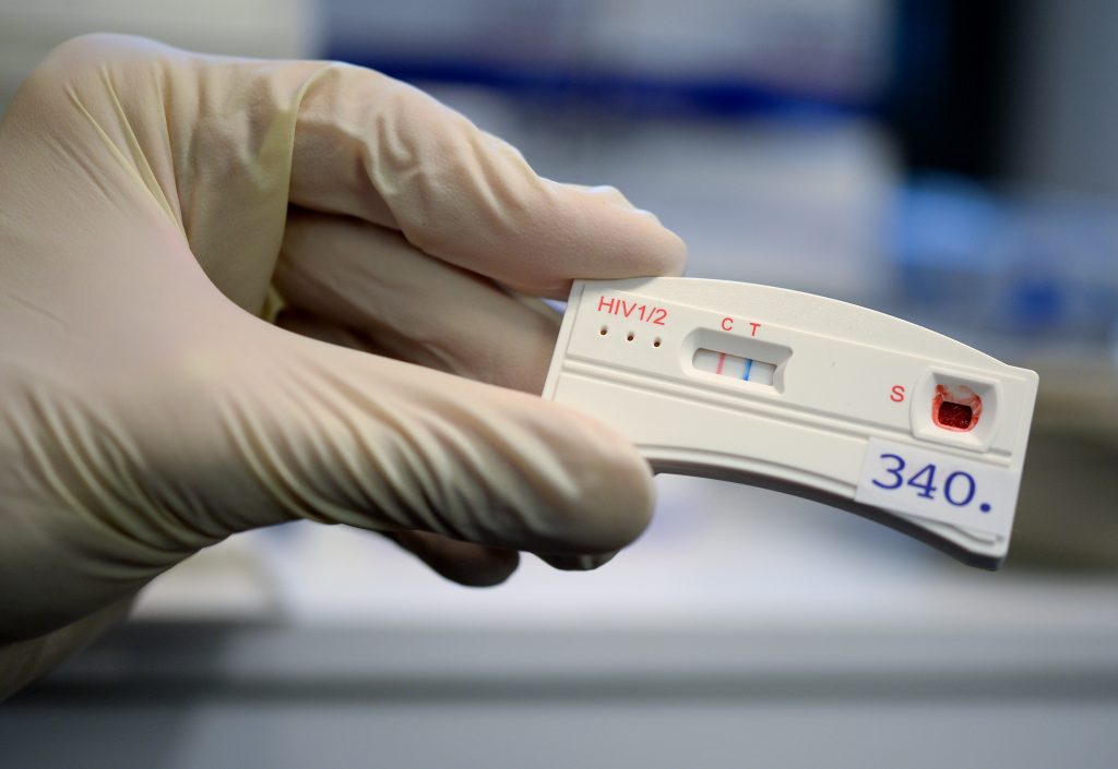 HIV-Teststreifen