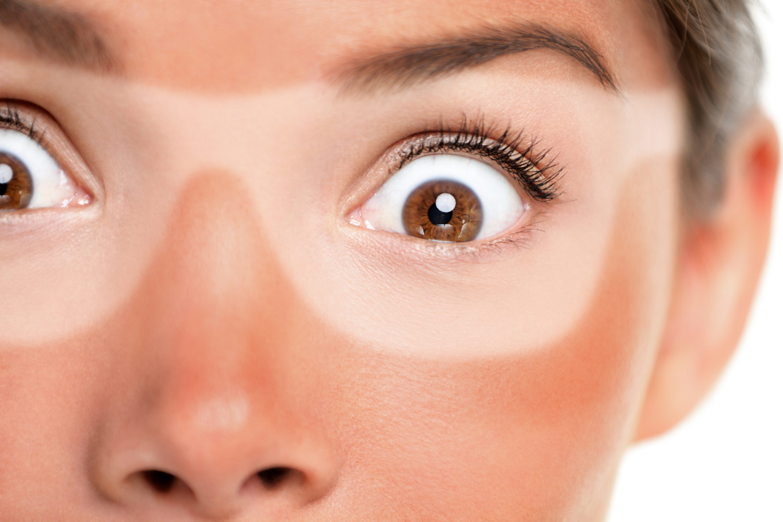 Tanlines-Trend: UV-Gefahr für Haut und Gesundheit