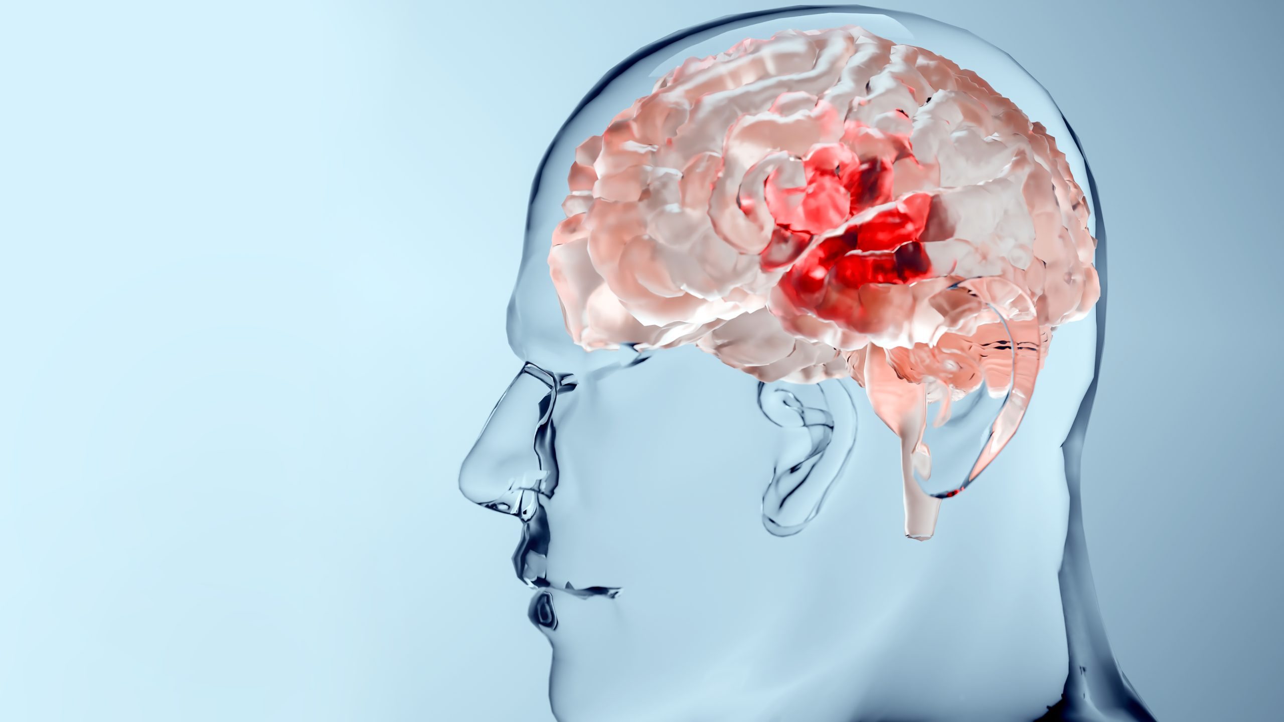 Hirnmetastasen bei Brustkrebs: Screening sinnvoll?